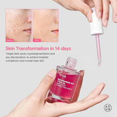 Anua Niacinamide 10 + TXA 4 Serum – Dark Spot Correcting and Brightening Face Serum 30mL