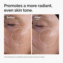 The Ordinary Glycolic Acid 7% Exfoliating Toner – Skin Texture Tone Luminosity Improving Facial Cleansing Skin Care 240mL