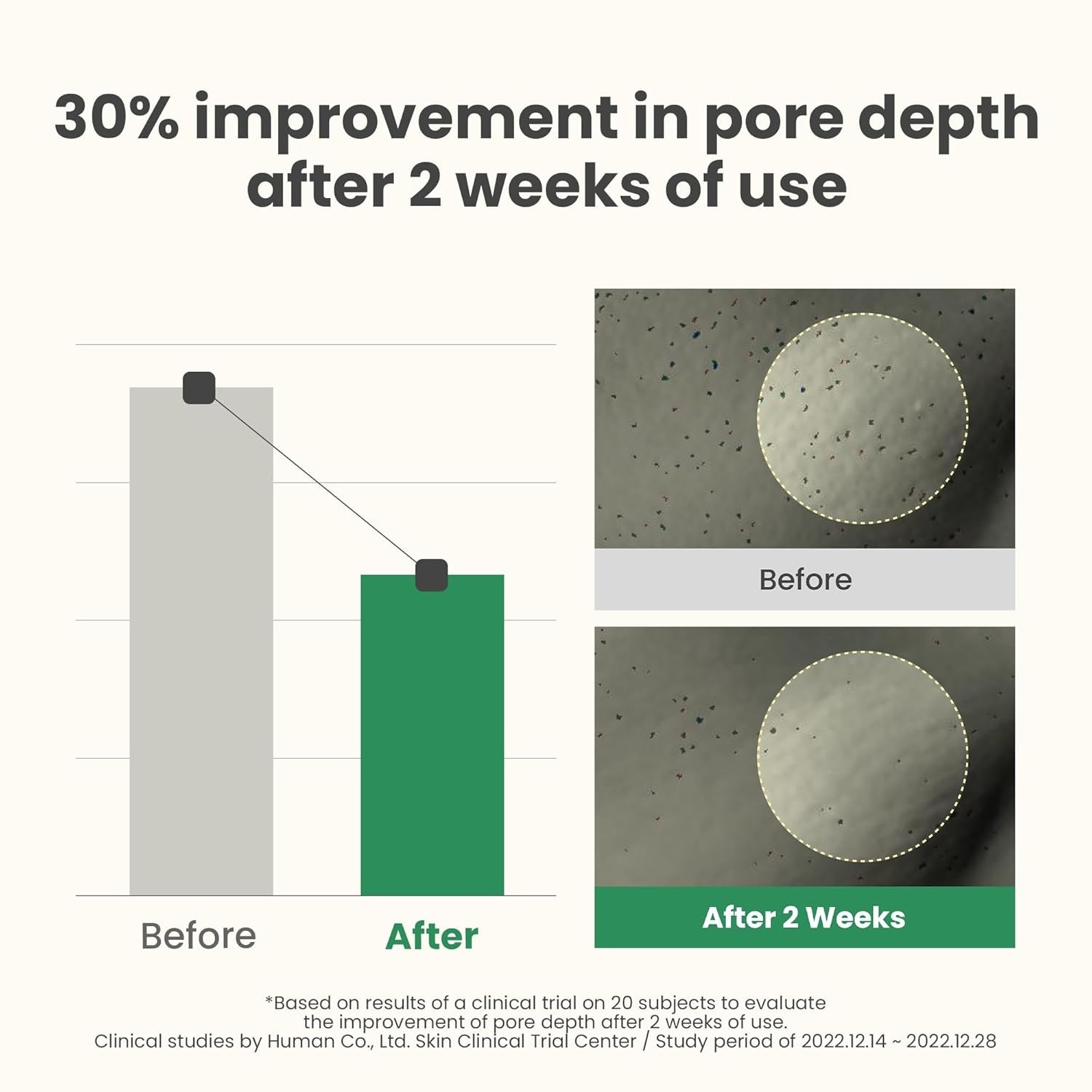 AXIS-Y LHA Peel & Fill Pore Balancing Cream – Exfoliating Sebum Control Hydrating Smooth Skin Face Moisturizer 50mL