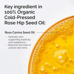 The Ordinary 100% Organic Cold-Pressed Rose Hip Seed Oil – Hydrating Brightening Anti Aging Face Oil 30mL