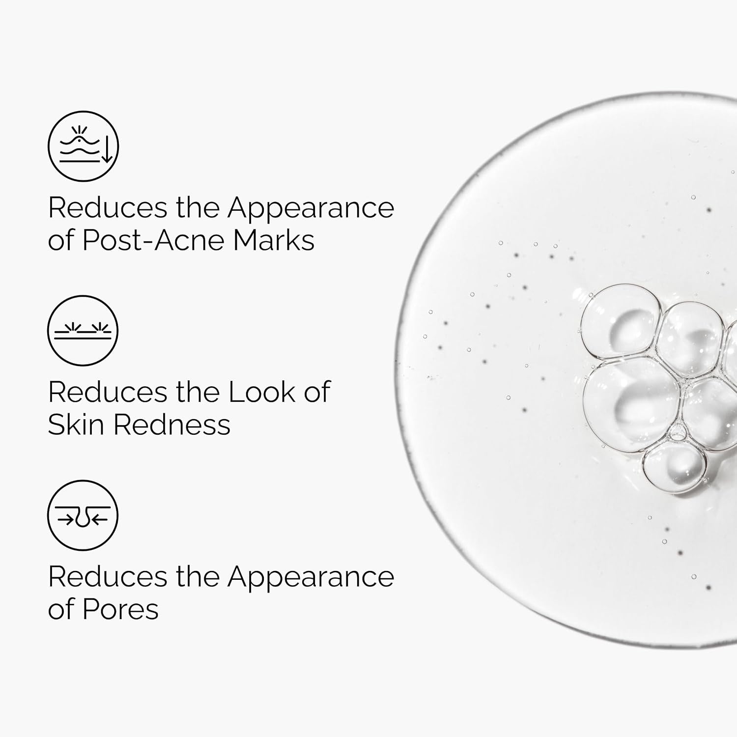 The Ordinary Aloe 2% + NAG 2% Solution – Soothing Blemish Prone Skin Acne Marks Fading Facial Serum 30mL