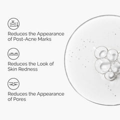 The Ordinary Aloe 2% + NAG 2% Solution – Soothing Blemish Prone Skin Acne Marks Fading Facial Serum 30mL