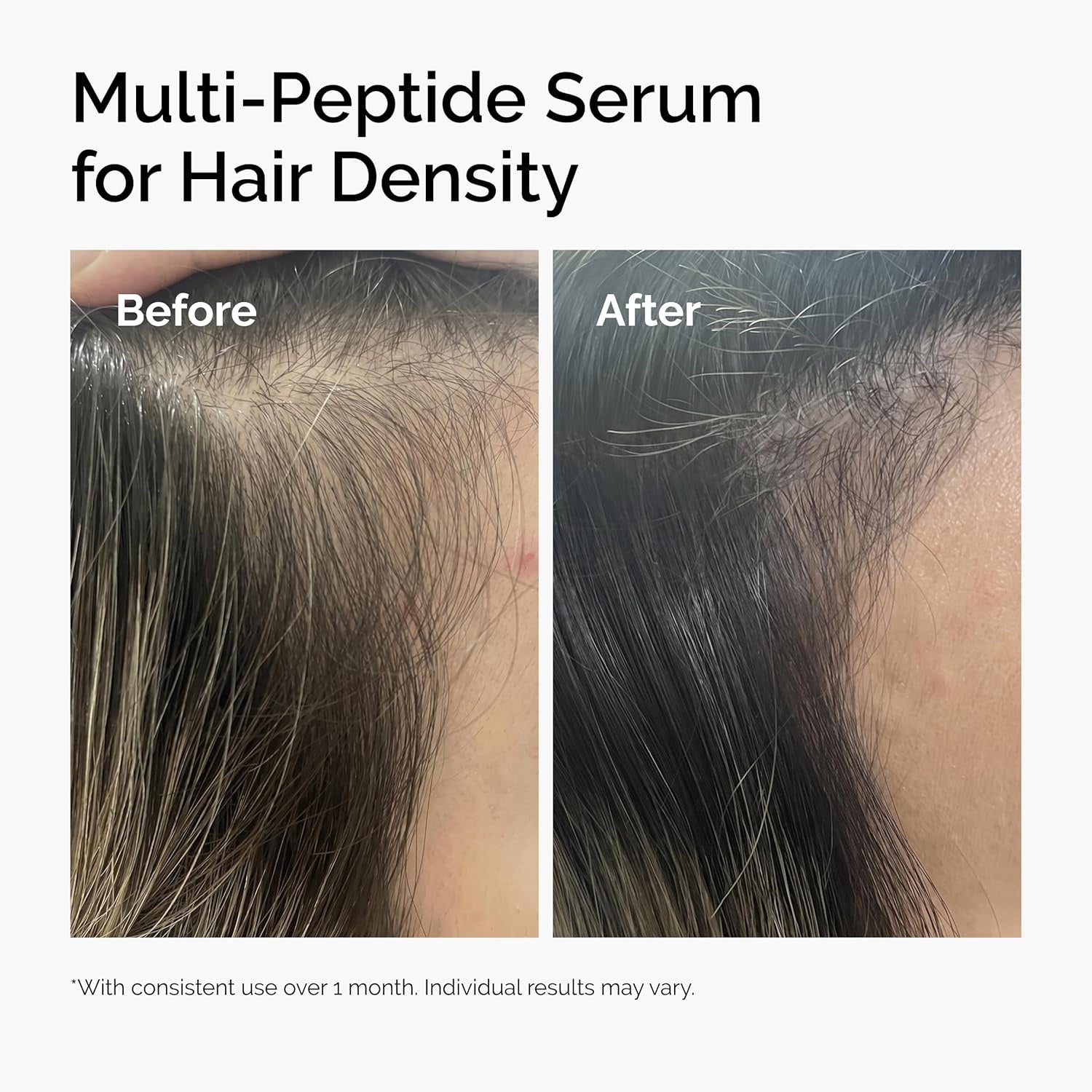 The Ordinary Multi-Peptide Serum for Hair Density – Thickening Fullness Boosting Scalp Care Hair Treatment 60mL